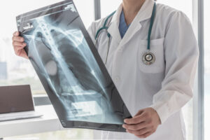 How Can Ross Mann Nursing Home and Medical Negligence Lawyers Help After a Radiological Error in Lexington, Kentucky?